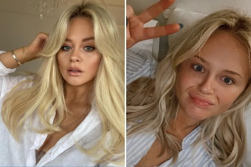 Emily Atack, de cara fresca, muestra sus pecas naturales en una selfie sin maquillaje 
