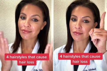 Soy estilista y la pérdida de cabello se debe a la forma en que está peinado, como si lo hiciera en un moño.