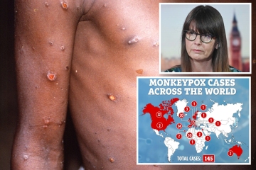 El Reino Unido dice que los contactos de viruela del mono deben autoaislarse durante 21 días a medida que se confirman más casos