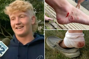 Segundo ataque de tiburón en el estado en una semana deja mutilado a un salvavidas adolescente