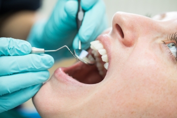 Soy dentista, cosas que sé al mirarte la boca, como si estuvieras embarazada
