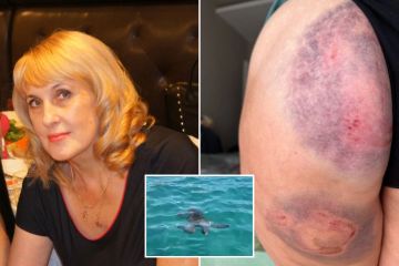 La tortuga marina me atacó y me arrastró hacia abajo - Pensé que me iba a morir 