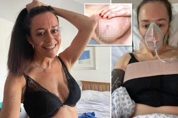 Mi operación de senos me salvó la vida, porque reveló que tenía una enfermedad mortal