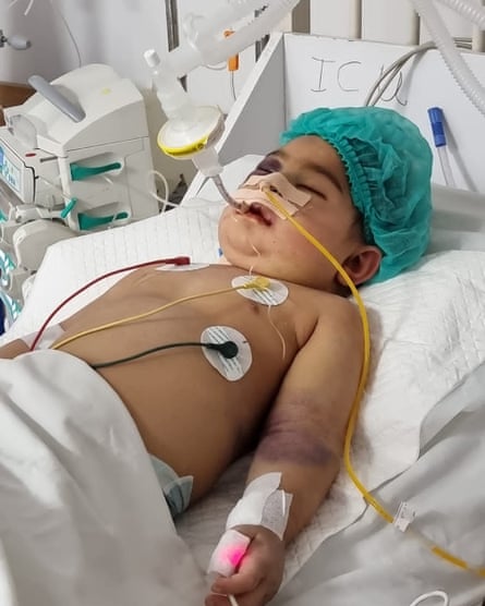 Niño en cama de hospital con monitores y flujo.