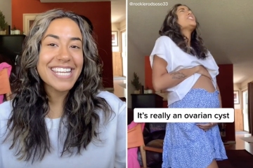 Parezco embarazada de nueve meses con un gran quiste ovárico, pero no me avergüenzo