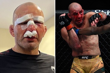 La leyenda de UFC Teixeira muestra la cara vendada en el hospital después de la brutal derrota de Hill