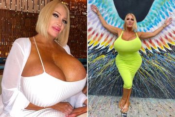 Me veo irreconocible en un recuerdo después de la cirugía para obtener senos de 54 pulgadas