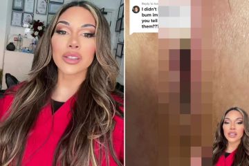 Fan de belleza mortificada después de que sus implantes en el trasero casi se caen