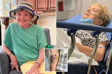 Nuestro viaje se convirtió en un infierno después de atrapar un insecto asesino silencioso en un jacuzzi