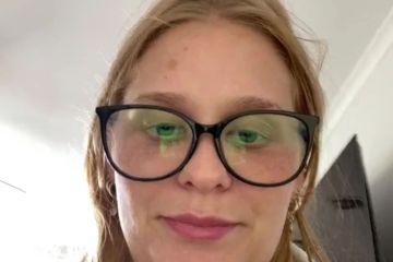 Decidí quitarme la grasa de la barbilla, pero me parezco a Peter Griffin