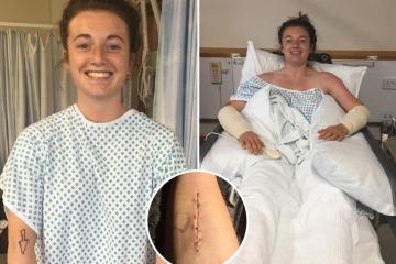 Los médicos le abrieron los brazos a un estudiante después de que una enfermedad rara cortara el suministro de sangre